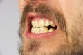 Closed human teeth grin, closeup, side view