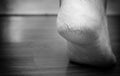 Closed-up of cracked heels, also known as fissures, a common foot problem. black and white tone Royalty Free Stock Photo