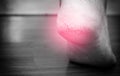 Closed-up of cracked heels with red spot, also known as fissures, a common foot problem. black and white tone Royalty Free Stock Photo