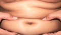 Closeup of abdominal surface woman fat, healthy care and beauty
