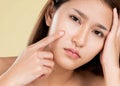 Closeup ardent asian woman worry about pimple. Acne problem concept. Royalty Free Stock Photo