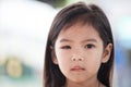 Closeup of asian child girl eye swell from bacteria Royalty Free Stock Photo