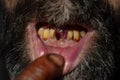 Closeup bad teeth man with caries tartar. The harm of alcohol and tobacco concept, smoker sick.