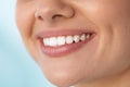 Closeup Of Beautiful Smile With White Teeth. Woman Mouth Smiling Royalty Free Stock Photo