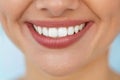 Closeup Of Beautiful Smile With White Teeth. Woman Mouth Smiling Royalty Free Stock Photo