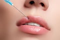 Closeup of beautiful woman gets injection in her lips. Full lips. Beautiful face and the syringe (plastic surgery and cosmetic inj