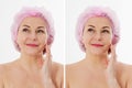 Closeup before after Beauty middle age woman face portrait. Before-after Spa anti wrinkled aging female body parts concept. Mid- Royalty Free Stock Photo