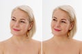 Closeup before after Beauty middle age woman face portrait. Before-after Spa anti wrinkled aging female body parts concept. Mid- Royalty Free Stock Photo