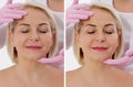 Closeup before after Beauty middle age woman face portrait. Before-after Spa anti wrinkled aging female body parts concept. Mid- Royalty Free Stock Photo