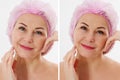 Closeup before after Beauty middle age woman face portrait. Before-after Spa anti wrinkled aging female body parts concept. Mid-