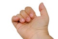 closeup of bitten and brittle nails without manicure, female hand with overgrown cuticle fingernails and tainted nail plate,