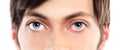 Closeup of blue eyes from a young man red and irritated eye with