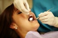 Closeup of dental patient exam