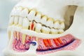 Closeup dental tooth model