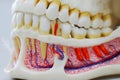 Closeup dental tooth model