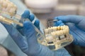 Closeup of dentist holding teeth model denture, showing what pulpitis looks like