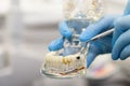 Closeup of dentist holding teeth model denture, showing what pulpitis looks like Royalty Free Stock Photo