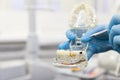 Closeup of dentist holding teeth model denture, showing what pulpitis looks like