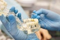 Closeup of dentist holding teeth model denture, showing what pulpitis looks like Royalty Free Stock Photo