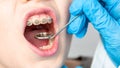 Dentist using an instrument to visualize the teeth of a child patient