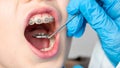 Dentist using an instrument to visualize the teeth of a child patient