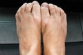 Closeup of dirty feet after wearing flip flops Royalty Free Stock Photo