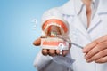 A dentist is pointing at the opened artificial jaw model