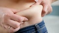 Closeup of fat folds on big belly of overweight woman. Concept of excessive weight, obese female, dieting and overweight