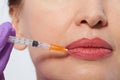 Closeup of female mouth and lips with botox and syringe needle in lip. Selective focus and macro face.