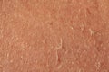 closeup on the flaky skin of an aging caucasian person. Shedding and peeling skin