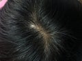 Closeup gray hair roots of an asian black hair. Top view from above