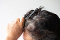 Closeup Hair grows on the head of an old woman