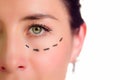 Closeup half of face caucasian woman with dotted lines drawn around left eye, preparing cosmetic surgery