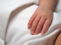 Closeup hand of a newborn with a skin peeling on white cloth. Skin allergies in newborn called Vernix. the concept of health care Royalty Free Stock Photo