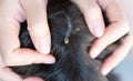 Closeup hand showing big tick parasite on a dog skin, selective focus Royalty Free Stock Photo