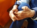 Closeup hands of asian old man suffering from leprosy, Thailand.