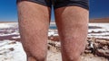 Human body legs with salt after swimming in Atacama salt lakes