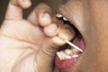 Lady Removing Leftover Food From Teeth With Tooth Pick