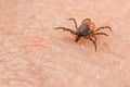 Dangerous parasitic castor bean tick at biting to a human skin. Ixodes ricinus or scapularis Royalty Free Stock Photo