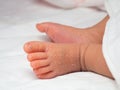 Closeup instep or foot of a newborn with a skin peeling on white cloth. Skin allergies in newborn called Vernix. the concept of he