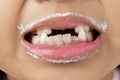 Closeup of little asian girl smiling with milk mustache on upper lip on white background