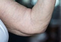 Closeup of loose elderly arm Royalty Free Stock Photo