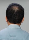 Back view of male hair head part bald