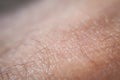 Closeup macro skin texture. Healthy caucasian skin