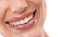 Closeup, mouth and teeth whitening with woman for beauty, makeup with gloss for hydration and dental health. Cosmetic