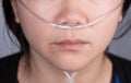 Nasal cannula for oxygen delivery on a woman patient