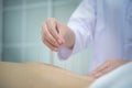 Closeup, patient getting acupuncture from acupuncturist