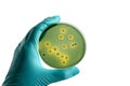 Closeup for plate bacteria culture growth on selective media