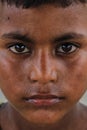 Closeup of a poor staring hungry orphan boy in a refugee camp with sad expression.