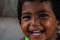 Closeup of a poor staring hungry orphan boy in a refugee camp with sad expression.